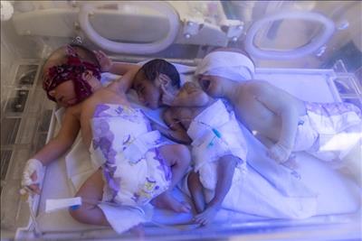 Kabul, Afghanistan: Các bác sĩ bệnh viện nhi quá tải vì số lượng bệnh nhân tăng nhanh