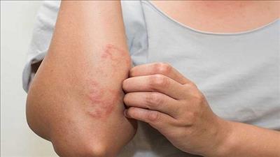 Cảnh báo ung thư khi cơ thể thường xuyên bị ngứa ở những bộ phận này