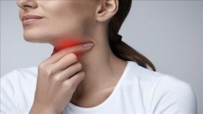Cẩn trọng trong điều trị viêm họng cấp lúc giao mùa